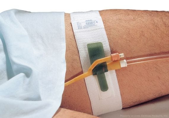 Strap Catheter Leg Band